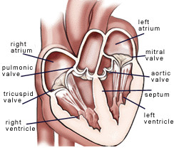Hình ảnh mô tả hẹp van động mạch phổi